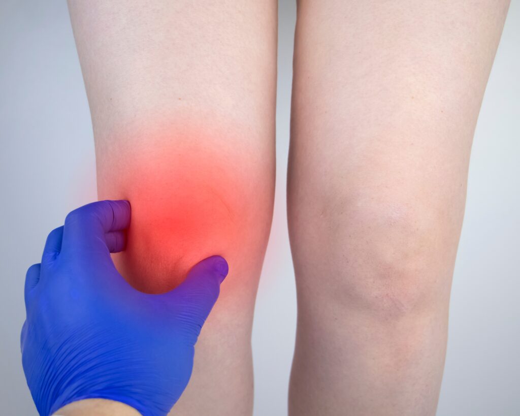 Knee Pain Injections Birmingham, Worcestershire