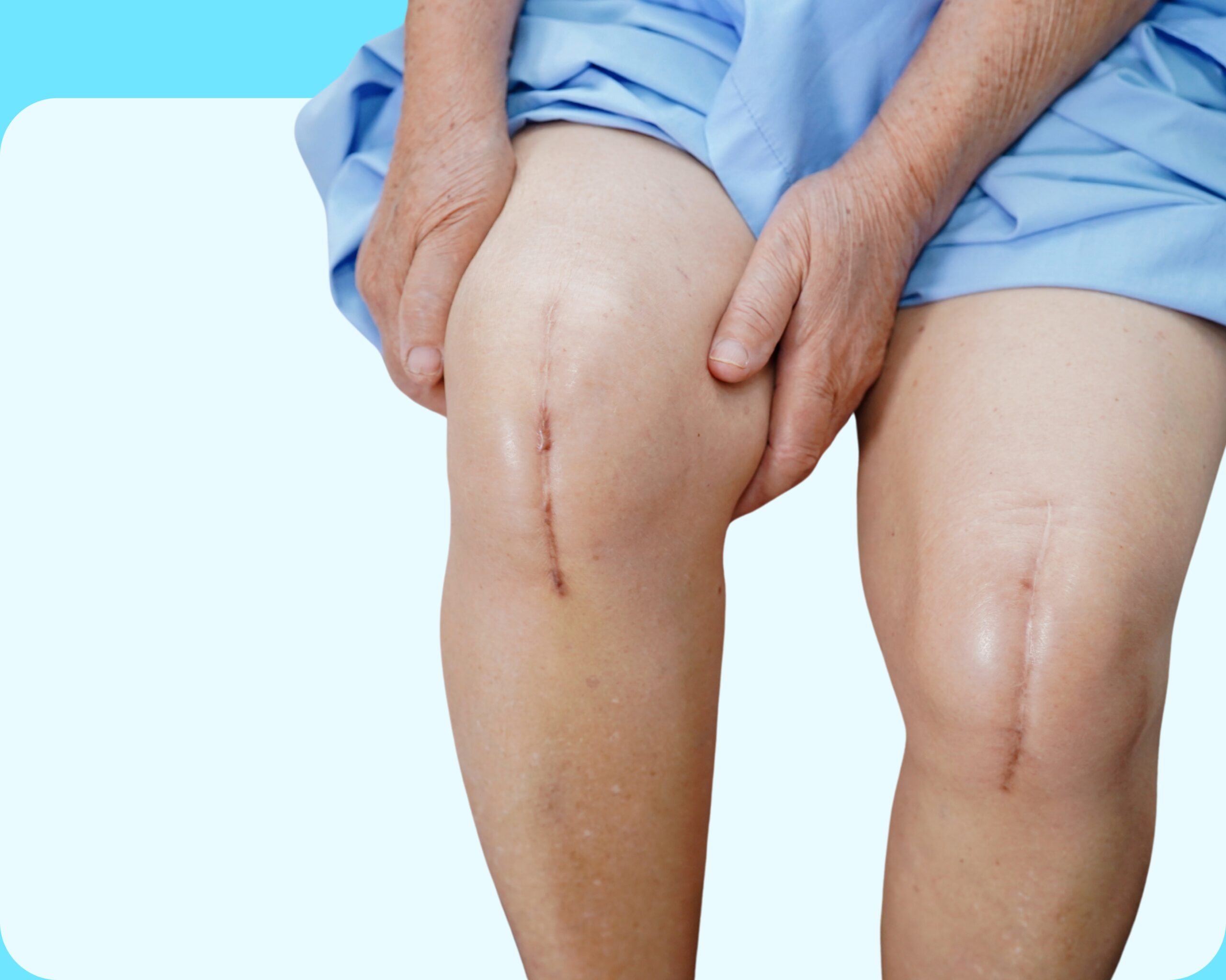 Rotator Cuff Repair Protocols & Recovery, Expert Knee Replacement