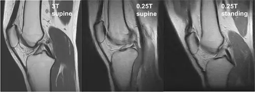 Open & Upright MRI Scan | No Claustrophobia, Pain-Free