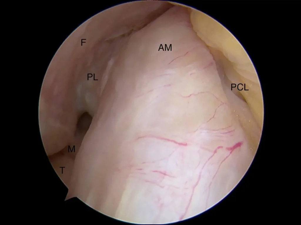 scope ACL