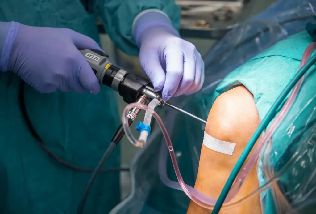 Arthroscopy more changed