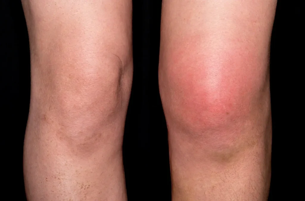 Knees more changed
