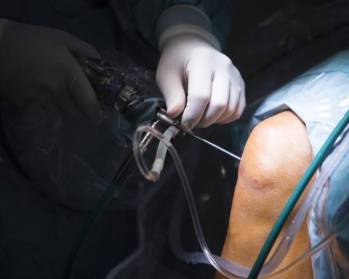 Knee Pain Injections in Worcestershire